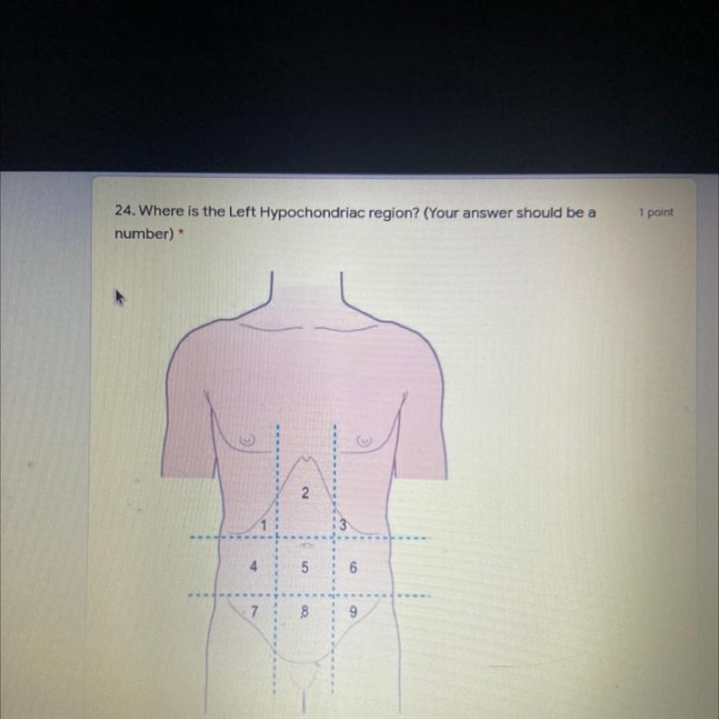 Where is the left hypochondriac region? your answer should be a number-example-1