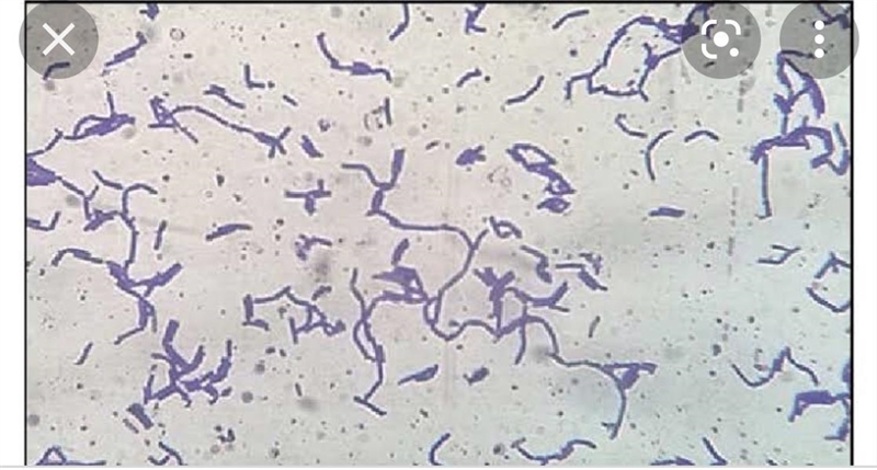 Bacteria looks more?-example-1