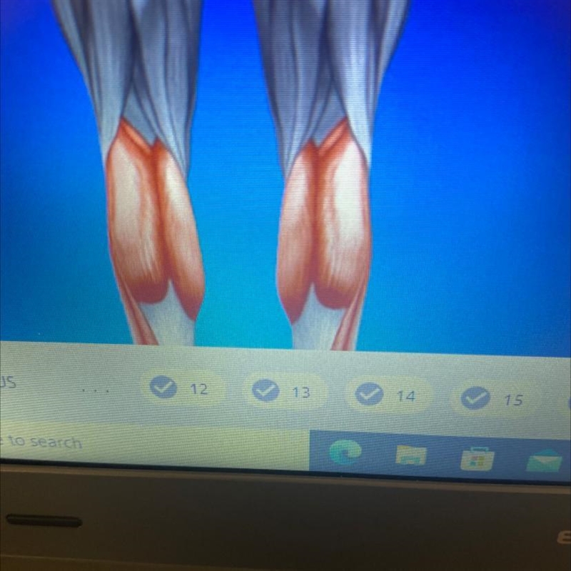 17. What is the name of this muscle?-example-1