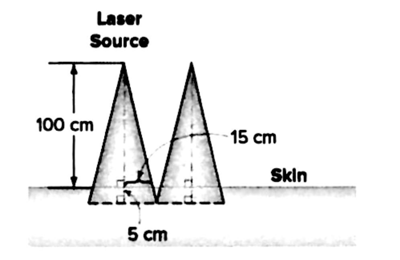 Which real-world scenario involves a right triangle?-example-1