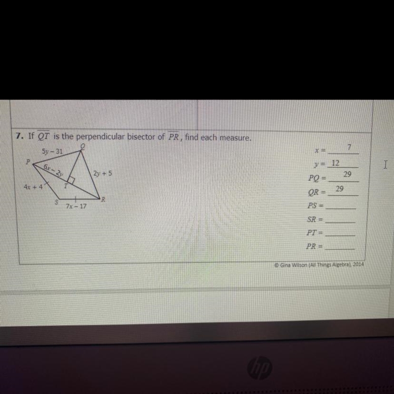 7. If QT is the perpendicular bisector of PR, find each measure.Sy - 31-PQ =OR =PS-example-1