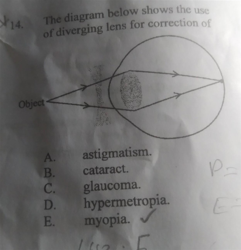 The diagram below shows the use of diverging lens for correction of​-example-1