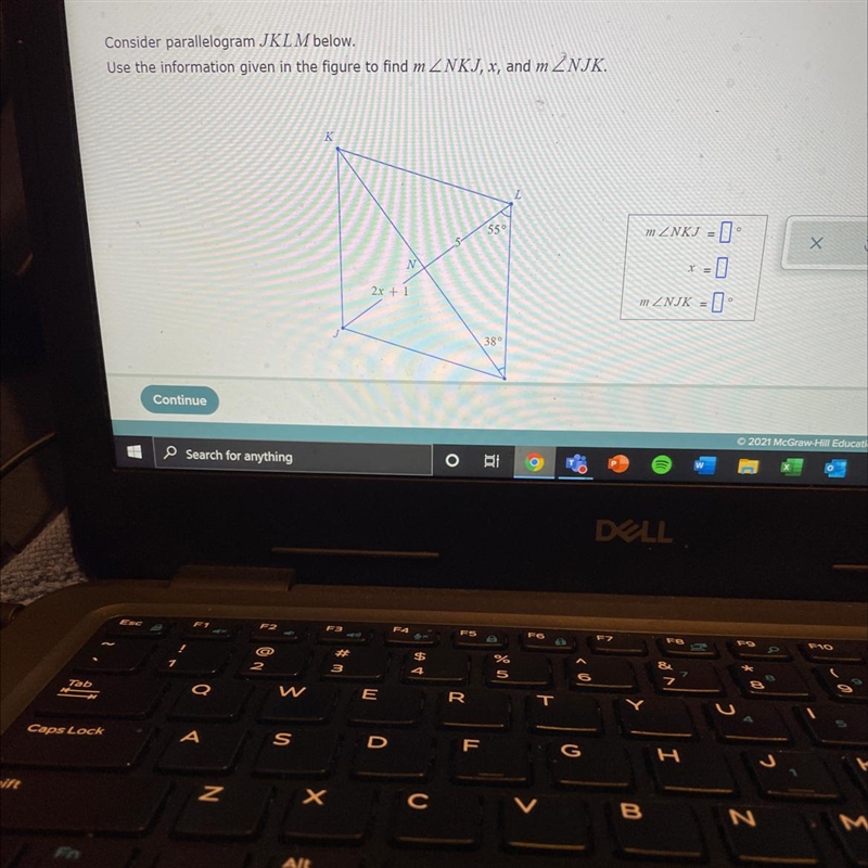 Consider parallelogram JKLM below.Use the information given in the figure to find-example-1