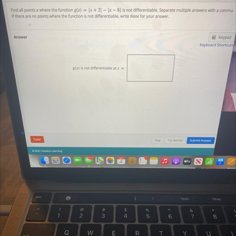 Help please! “find all points (x) where the function g(x)= |x+2| - |x-8| is not differentiable-example-1