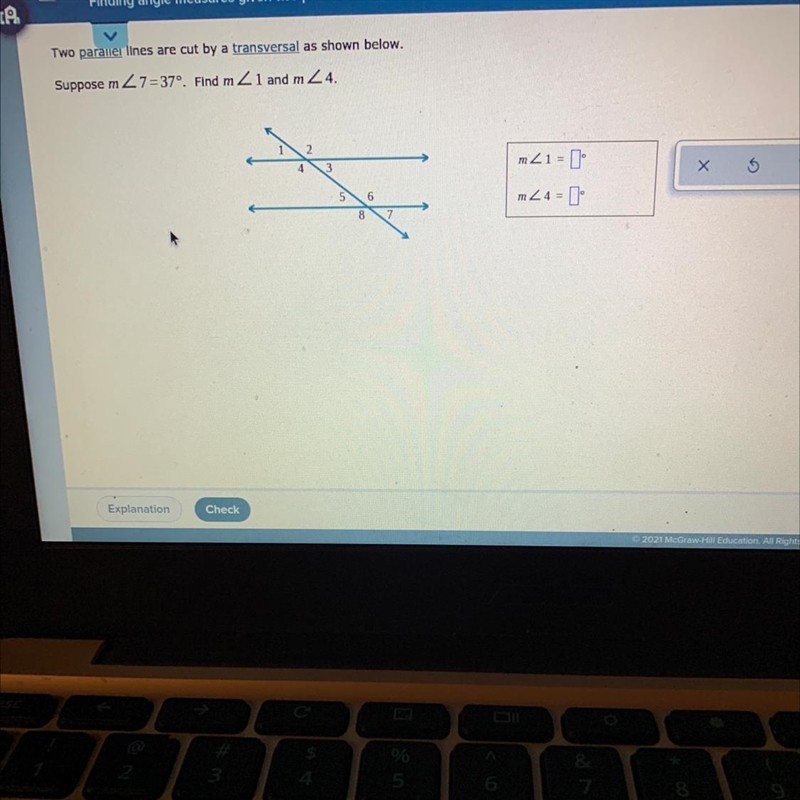 HELP ME PLEASE I JUST NEED THIS QUESTIONN :( it’s parallel lines-example-1