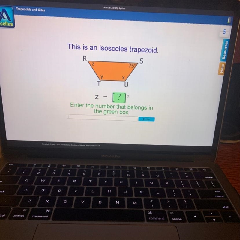 This is an isosceles trapezoid. R_ S Z 75% Z-example-1