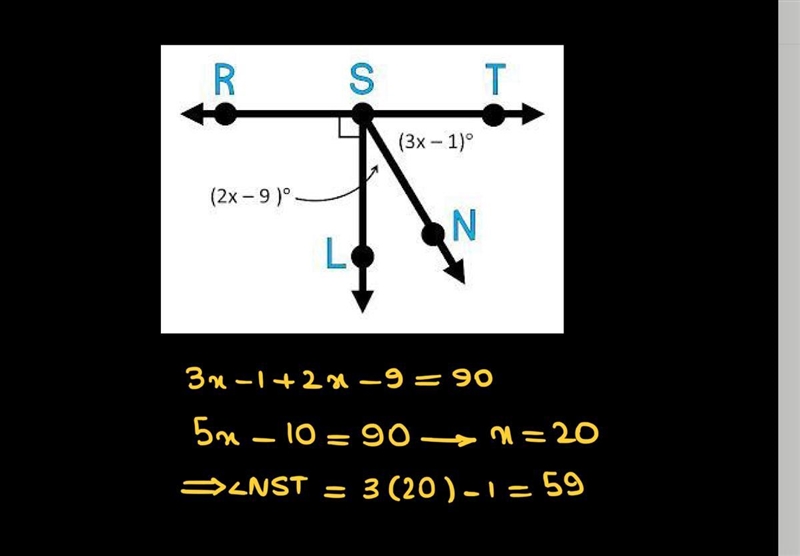 #15: m∠NST = ____° need answer-example-1