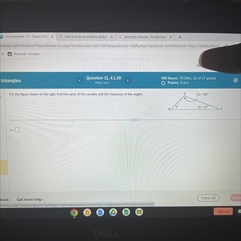 Part 1 of 4 For the figure shown on the right, find the value of the variable and-example-1