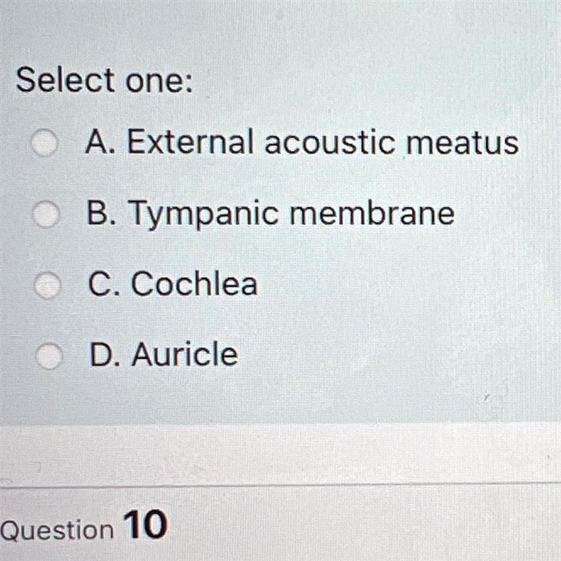 Which structure of the external ear collects sound waves?-example-1