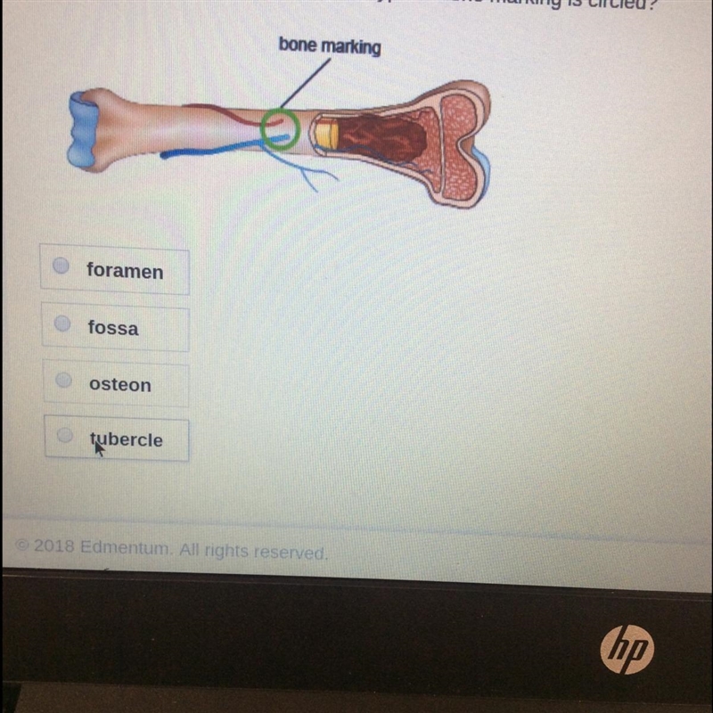 In this diagram of a long bone, which type of bone marking is circled? anatomical-example-1