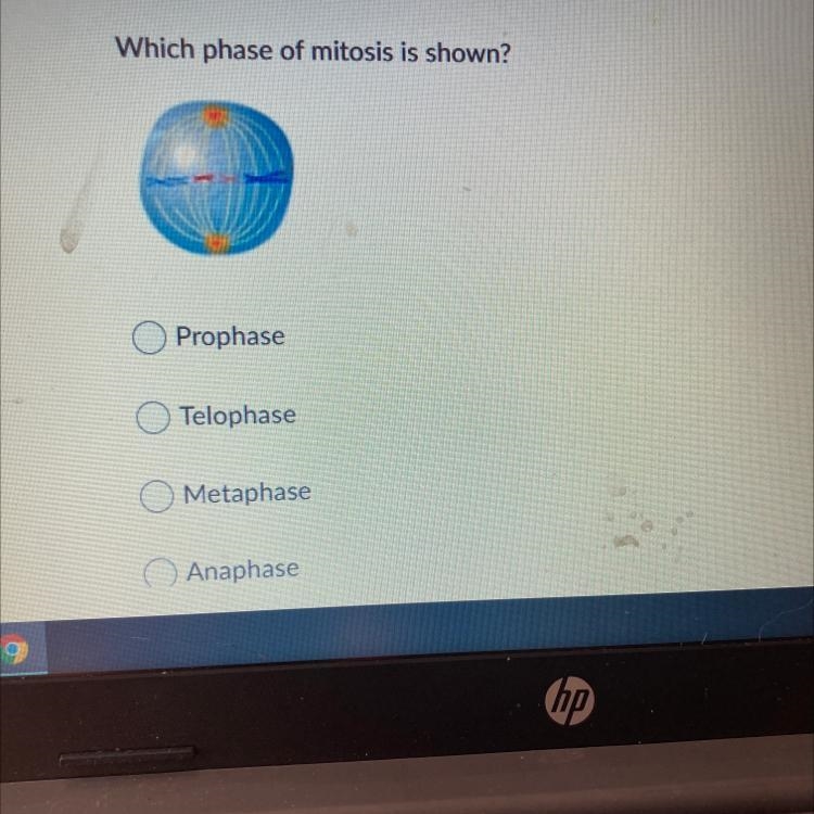 Which phase of mitosis is shown-example-1