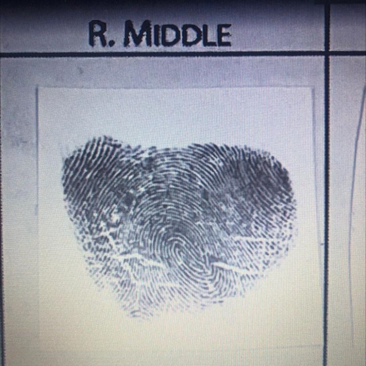 What fingerprint pattern is this-example-1