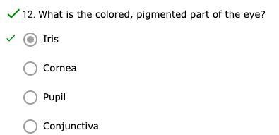 What is the colored, pigmented part of the eye?-example-1