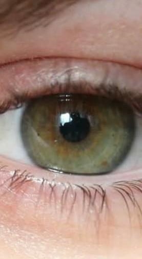 What is the rarest eye colour in the world?! Pls help!! It is my BIO homework...-example-1