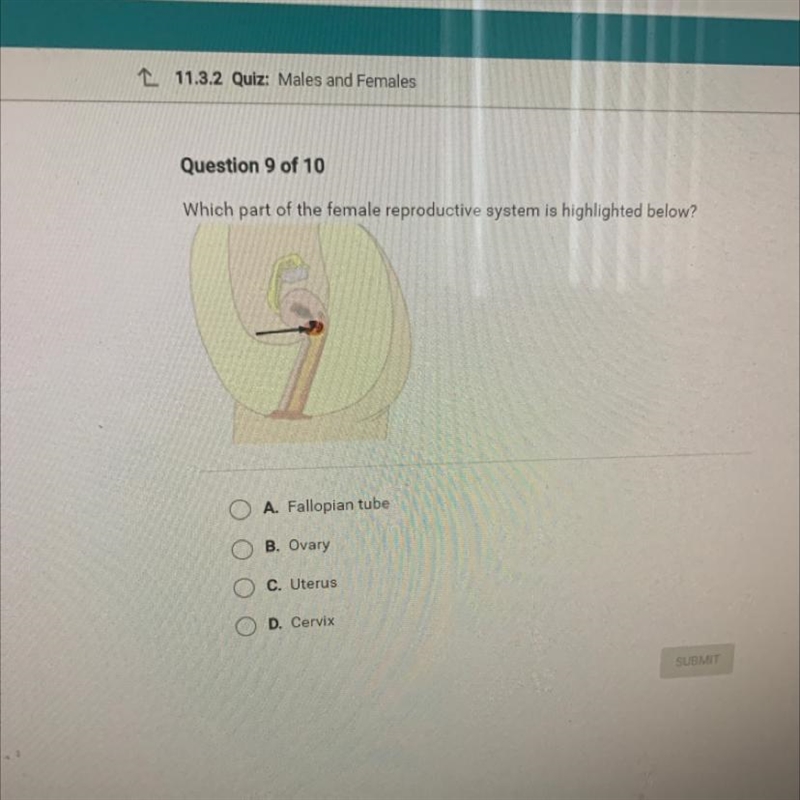 Which part of the female reproductive system is highlighted below? A. Fallopian tube-example-1