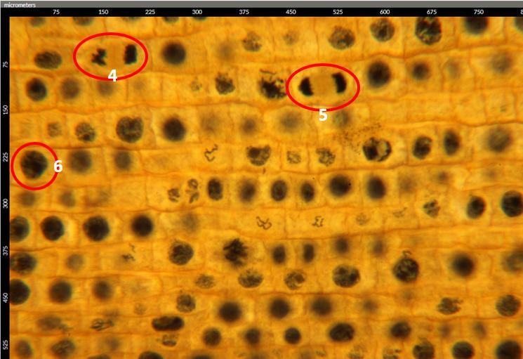 I NEED HELP IDENTIFYING THE STEPS OF MITOSIS!!! PLZ HELP THIS IS DUE TODAY-example-2