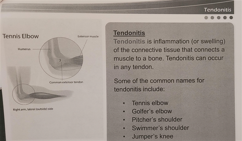 Jumper's knee is a common name for which injury?-example-2