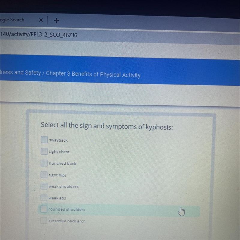 Select all the sign and symptoms of kyphosis: swayback tight chest hunched back tight-example-1