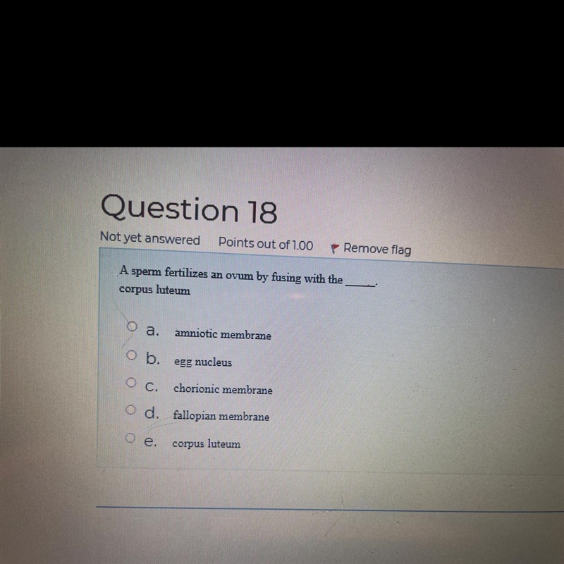 Plssss helpppo ASAP DONT GUESS-example-1