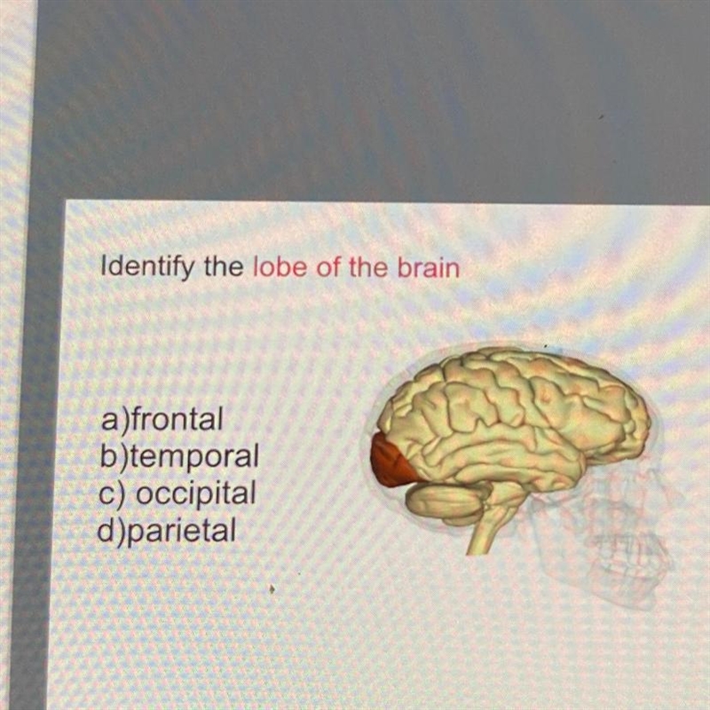 Identify the lobe of the brain a)frontal b)temporal c) occipital d)parietal-example-1