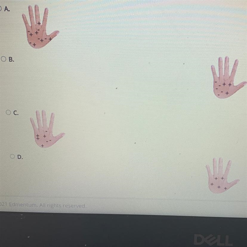 Select the correct answer. Which hand is negatively charged?-example-1