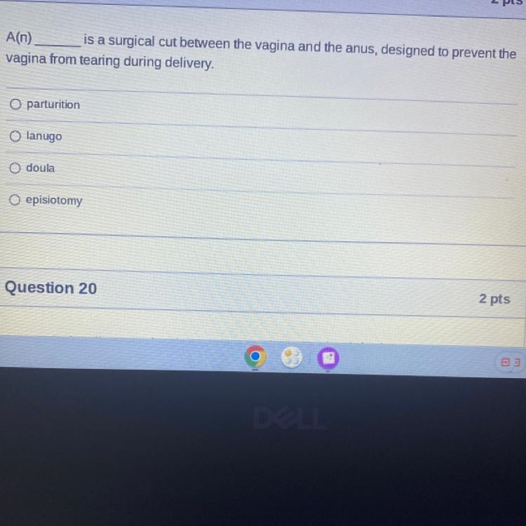 Why r these questions so hard-example-1