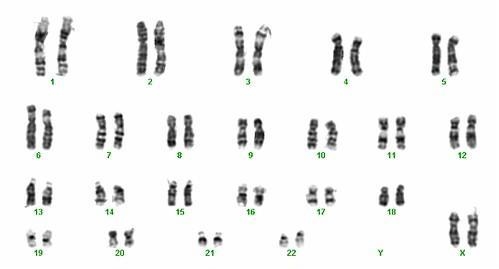 Karyotypes are helpful in: determining the sex of children.identifying genetic diseases-example-1