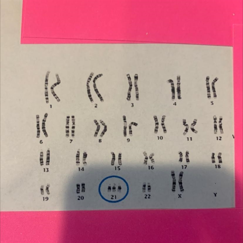 What effects will result in an individual with this karyotype?-example-1