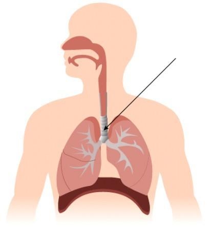 The structure identified in the image above is called theQuestion options:A) bronchioles-example-1