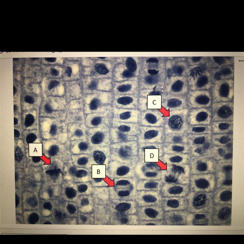 The diagram below shows a microscope image taken if a eukaryotic organism. Some cells-example-1