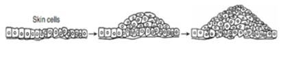 7. The diagram below represents cellular growth that can occur in human skin after-example-1