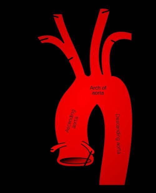 The common carotid arteries branch directly off of the aorta. true or false-example-1