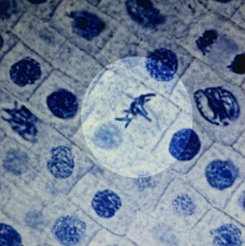 What phase of mitosis is highlighted in the slide below? Metaphase Telophase Anaphase-example-1