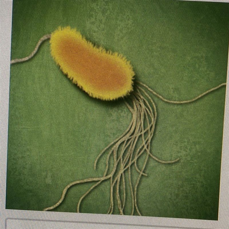 What morphology is represented in the picture? O Spirilla O Rod shaped O Filamentous-example-1