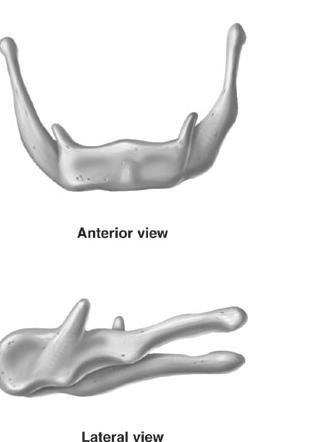 Identify the bone. This is all that was given to me and so far I've deciphered that-example-1