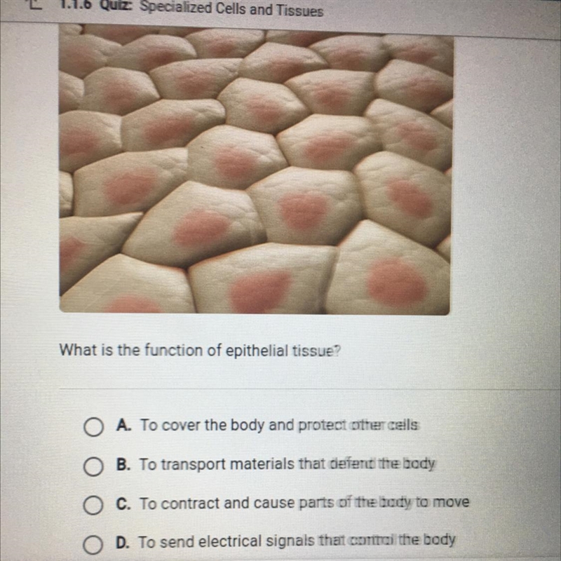 Can someone plz help me? “The picture shows epithelial tissue.”-example-1