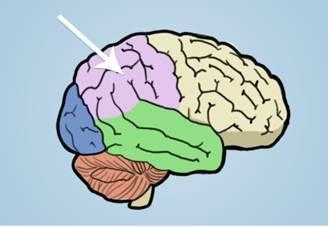 What part of the brain is the arrow pointing to in the diagram below? Occipital lobe-example-1