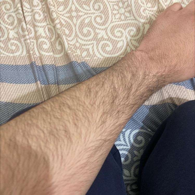 I’m 17, are my arms hairy?-example-1