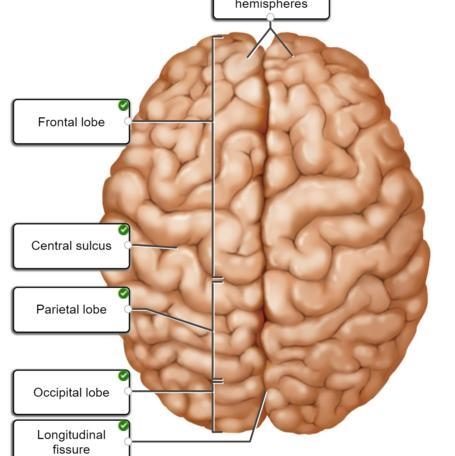 Correctly label the following anatomical features of the surface of the brain.-example-1