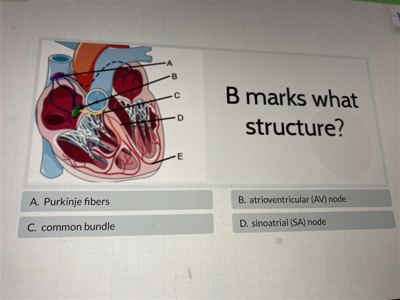 Please help meeeeeee-example-1