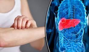 What is liver cancer signs-example-1