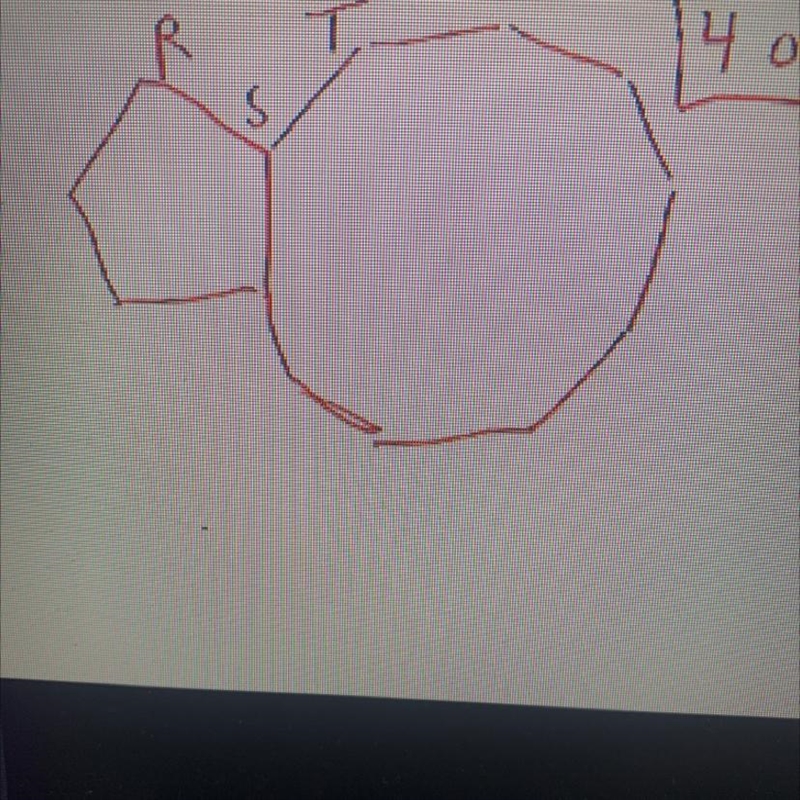 What is the measure of rst its a pentagon and a nonagon-example-1