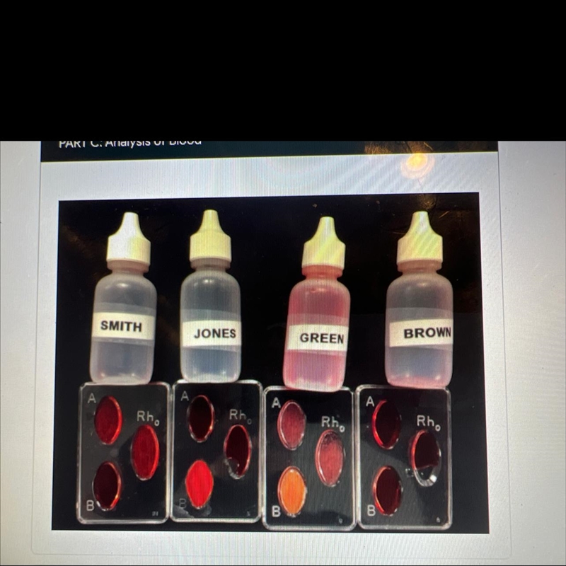 Identify what type of blood each one is.-example-1