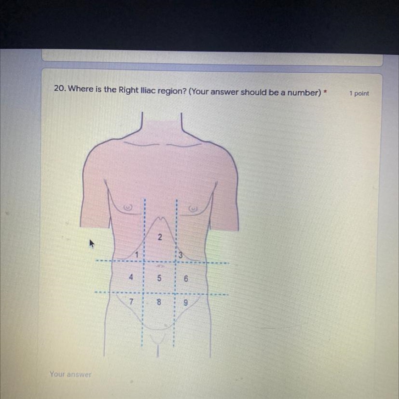 Where is the right iliac region? your answer should be a number-example-1